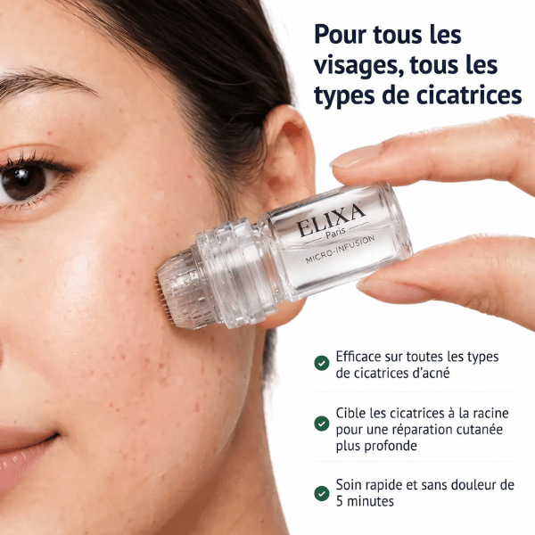 Kit Micro Infusion Anti-Acné